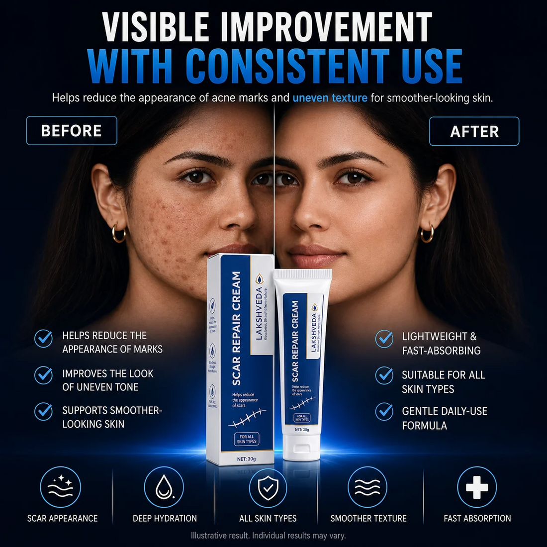 ScarSmooth™- Great for all types of marks